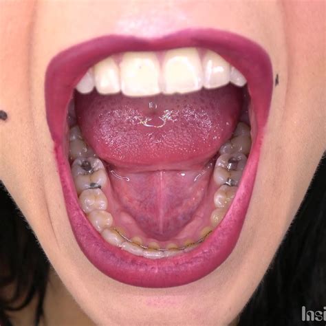 teeth porn